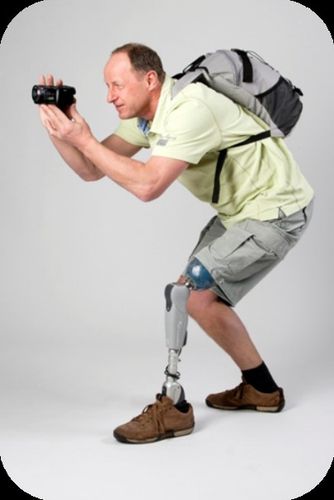 symbionic 3全智能大腿假-贵阳市残联假肢矫形器装配站